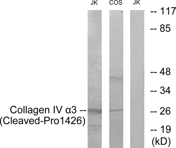 Anti-Cleaved-COL4A3-P1426 antibody (1407-1456 aa) (STJ90077) – Figure 1 of 1