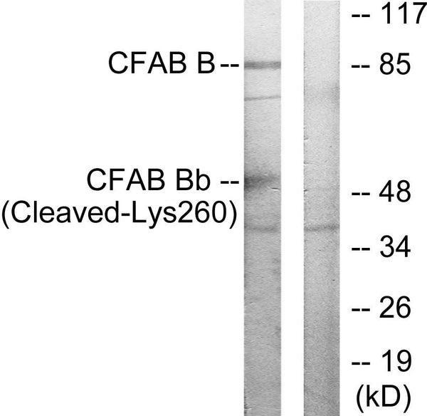 Anti-Cleaved-CFB-K260 antibody (241-290 aa) (STJ90079) - Figure 1 of 1