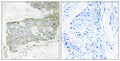 Anti-Cleaved-F7-R212 antibody (171-220 aa) (STJ90080) – Figure 1 of 1