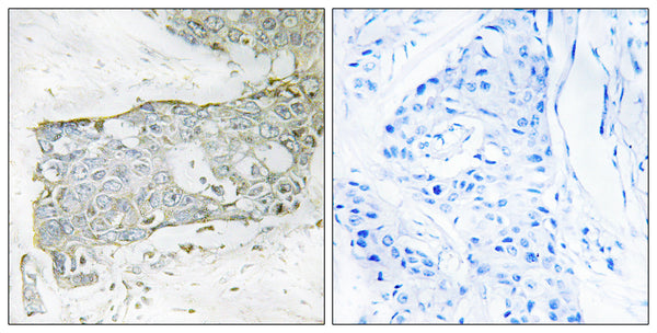 Anti-Cleaved-F7-R212 antibody (171-220 aa) (STJ90080) – Figure 1 of 1