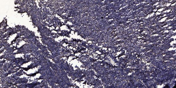 Anti-Cleaved-ITIH4-R661 antibody (612-661 aa) (STJ90094) – Figure 1 of 1
