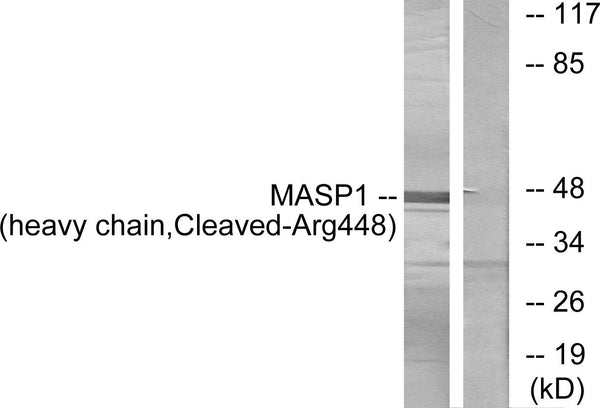 Anti-Cleaved-MASP1-R448 antibody (399-448 aa) (STJ90096) - Figure 1 of 2