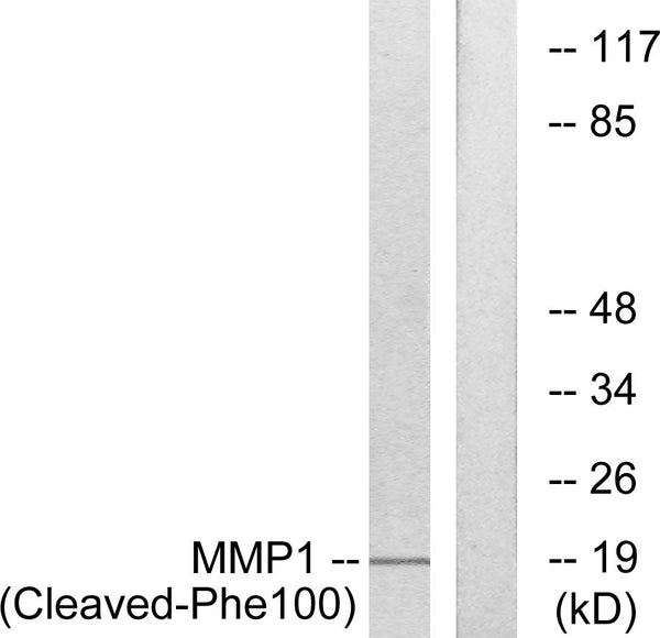 Anti-Cleaved-MMP1-F100 antibody (81-130 aa) (STJ90098) – Figure 1 of 1