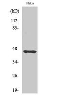 Anti-Cleaved-KLKB1-R390 antibody (341-390 aa) (STJ90101) – Figure 1 of 1