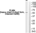 Anti-Cleaved-PLG-V98 antibody (79-128 aa) (STJ90102) – Figure 1 of 1