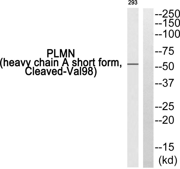 Anti-Cleaved-PLG-V98 antibody (79-128 aa) (STJ90102) – Figure 1 of 1