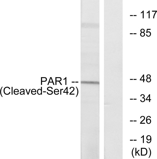 Anti-Cleaved-F2R-S42 antibody (23-72 aa) (STJ90103) – Figure 1 of 1