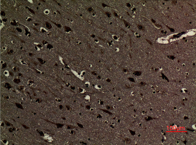 Anti-Di-Methyl-Histone H3-Lys5 antibody (STJ90112) – Figure 1 of 1