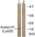 Anti-Acetyl-H1-8-K25 antibody (131-180 aa) (STJ90116) – Figure 1 of 1