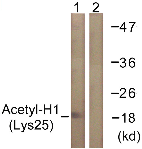 Anti-Acetyl-H1-8-K25 antibody (131-180 aa) (STJ90116) – Figure 1 of 1
