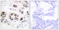 Anti-Acetyl-H2AZ1-K5 antibody (1-50 aa) (STJ90117) – Figure 1 of 1