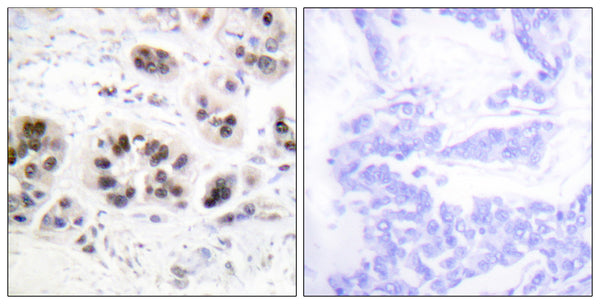 Anti-Acetyl-H2AZ1-K5 antibody (1-50 aa) (STJ90117) – Figure 1 of 1