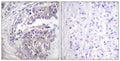 Anti-Acetyl-H2BC12L-Lys5 antibody (1-50 aa) (STJ90118) – Figure 1 of 1