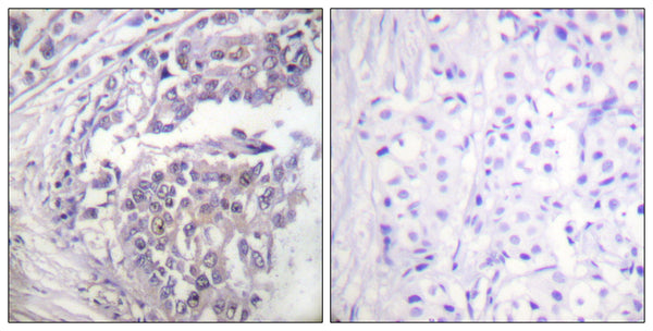 Anti-Acetyl-H2BC12L-Lys5 antibody (1-50 aa) (STJ90118) – Figure 1 of 1