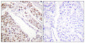 Anti-Acetyl-H2BC12L-K12 antibody (10-59 aa) (STJ90119) – Figure 1 of 1