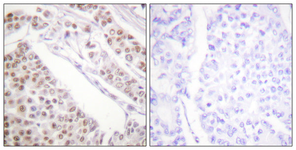 Anti-Acetyl-H2BC12L-K12 antibody (10-59 aa) (STJ90119) – Figure 1 of 1