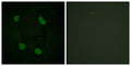Anti-Acetyl-Histone H3-Lys14 antibody (1-50 aa) (STJ90122) – Figure 1 of 1