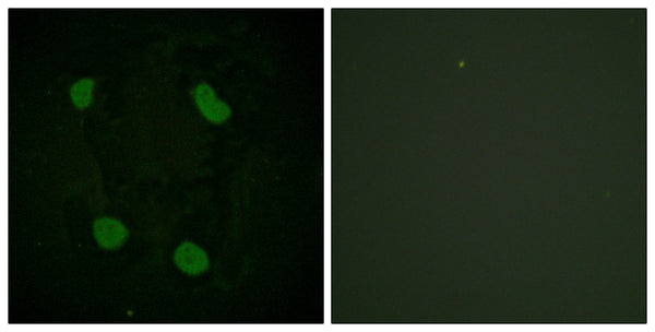 Anti-Acetyl-Histone H3-Lys14 antibody (1-50 aa) (STJ90122) – Figure 1 of 1