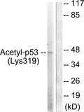 Anti-Acetyl-TP53-K319 antibody (283-332 aa) (STJ90130) – Figure 1 of 1