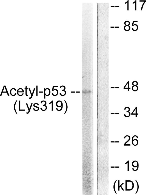 Anti-Acetyl-TP53-K319 antibody (283-332 aa) (STJ90130) – Figure 1 of 1