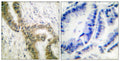 Anti-Acetyl-TP53-K386 antibody (344-393 aa) (STJ90132) – Figure 1 of 1