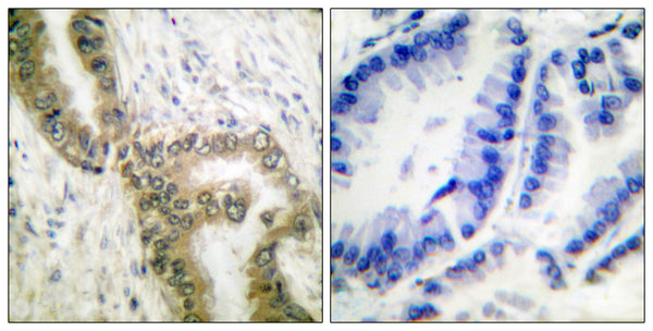 Anti-Acetyl-TP53-K386 antibody (344-393 aa) (STJ90132) – Figure 1 of 1