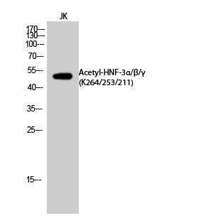 Anti-Acetyl-FOXA1-Lys264/253/211 antibody (231-280 aa) (STJ90141) – Figure 1 of 1
