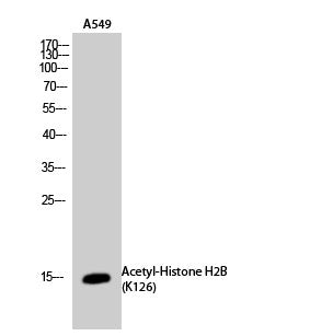 Anti-Acetyl-H2BC1-Lys126 antibody (78-127 aa) (STJ90142) – Figure 1 of 1