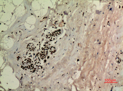 Anti-Acetyl-TP53-Lys370 antibody (331-380 aa) (STJ90150) - Figure 1 of 4