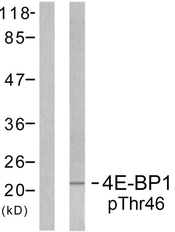 Anti-Phospho-EIF4EBP1-Thr46 antibody (13-62 aa) (STJ90162) – Figure 1 of 1