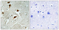 Anti-Phospho-4E-BP1-Thr69 antibody (35-84 aa) (STJ90163) – Figure 1 of 1