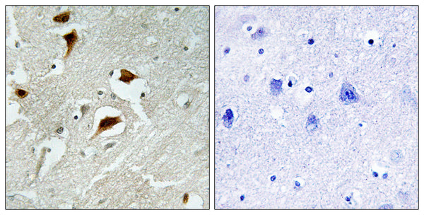 Anti-Phospho-4E-BP1-Thr69 antibody (35-84 aa) (STJ90163) – Figure 1 of 1
