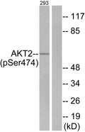Anti-Phospho-AKT2-Ser474 antibody (432-481 aa) (STJ90169) – Figure 1 of 1