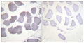 Anti-Phospho-PRKAB1-Ser182 antibody (147-196 aa) (STJ90171) – Figure 1 of 1