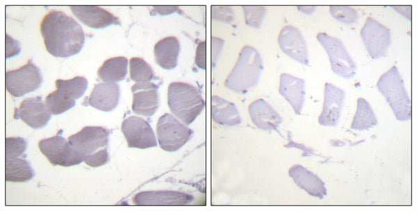 Anti-Phospho-PRKAB1-Ser182 antibody (147-196 aa) (STJ90171) – Figure 1 of 1