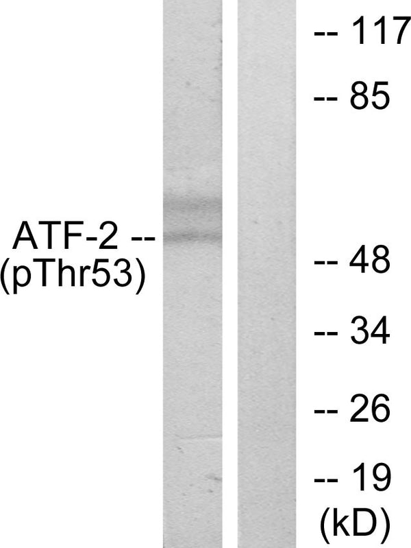 Anti-Phospho-ATF2-Thr71 antibody (38-87 aa) (STJ90186) – Figure 1 of 1