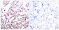 Anti-Phospho-ATF2-Thr73 antibody (40-89 aa) (STJ90187) – Figure 1 of 1