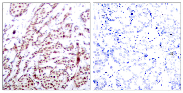Anti-Phospho-ATF2-Thr73 antibody (40-89 aa) (STJ90187) – Figure 1 of 1