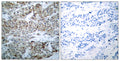 Anti-Phospho-BAD-Ser112 antibody (78-127 aa) (STJ90188) – Figure 1 of 1