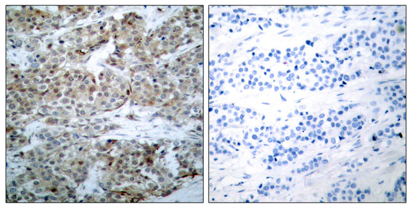 Anti-Phospho-BAD-Ser112 antibody (78-127 aa) (STJ90188) – Figure 1 of 1