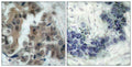 Anti-Phospho-BAD-Ser136 antibody (102-151 aa) (STJ90189) – Figure 1 of 1