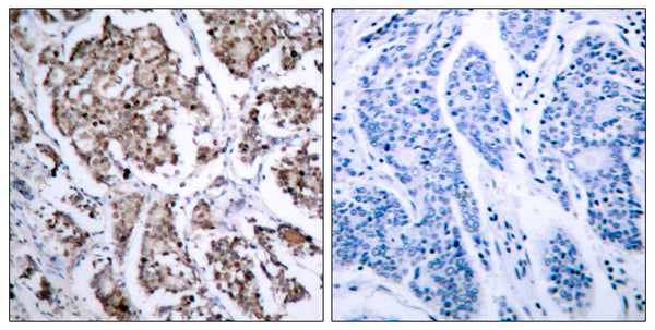 Anti-Phospho-BAD-Ser155 antibody (119-168 aa) (STJ90190) – Figure 1 of 1