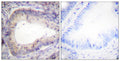 Anti-Phospho-BCL2-Thr69 antibody (46-95 aa) (STJ90193) – Figure 1 of 1