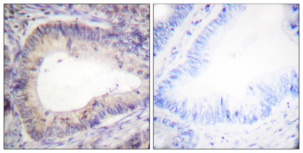 Anti-Phospho-BCL2-Thr69 antibody (46-95 aa) (STJ90193) – Figure 1 of 1