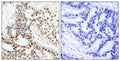 Anti-Phospho-BRCA1-Ser1423 antibody (1391-1440 aa) (STJ90198) – Figure 1 of 1
