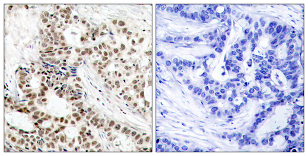 Anti-Phospho-BRCA1-Ser1423 antibody (1391-1440 aa) (STJ90198) – Figure 1 of 1