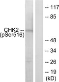Anti-Phospho-CHEK2-Ser516 antibody (486-535 aa) (STJ90224) – Figure 1 of 1