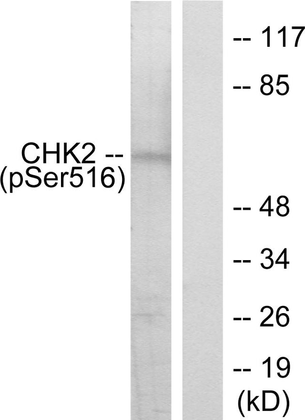 Anti-Phospho-CHEK2-Ser516 antibody (486-535 aa) (STJ90224) – Figure 1 of 1