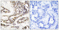 Anti-Phospho-CREB1-Ser129 antibody (96-145 aa) (STJ90234) – Figure 1 of 1