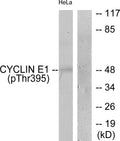 Anti-Phospho-CCNE1-Thr395 antibody (361-410 aa) (STJ90241) – Figure 1 of 1